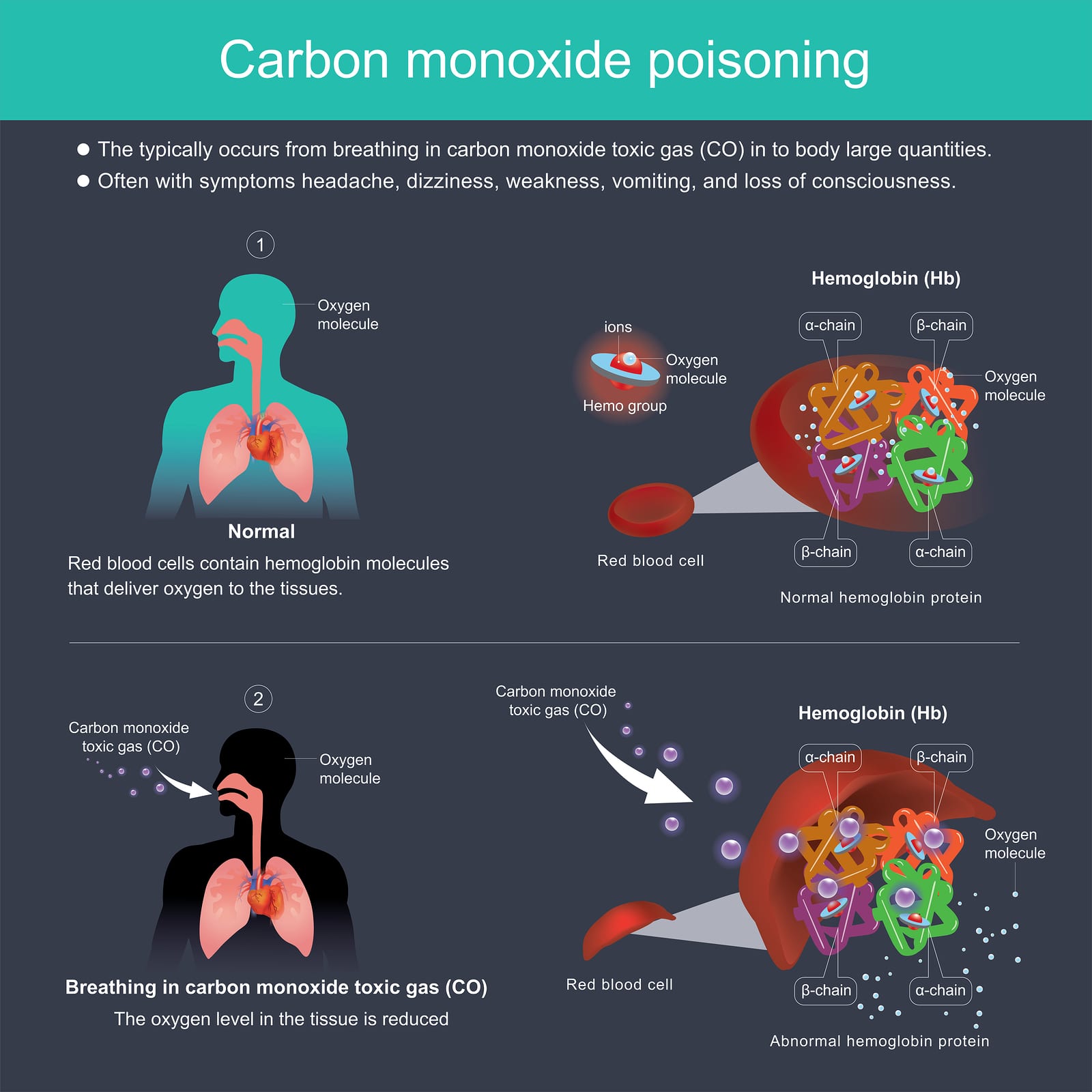 Carbon Monoxide poisoning